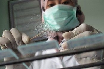 Di Tempat Ini, Dahak Pasien TBC Diwarnai Lalu Diamati