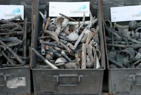OrthoMetals (Foto: SWNS) OrthoMetals (Foto: SWNS)