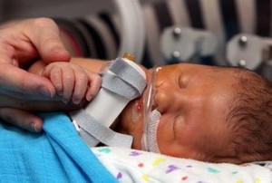 Bayi Baru Lahir Ini Idap Gangguan yang Belum Pernah Ada di Dunia