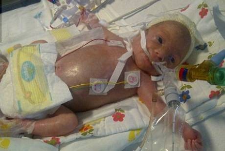 Bayi 11 Hari Meninggal di Rumah Sakit karena Petugas Malas Cuci Tangan