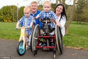 Cerebral Palsy Sebabkan Bocah Kembar Ini Tak Identik Lagi