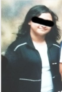 Terobsesi Turunkan Bobot 20 Kg, Gadis Ini Sempat Kena Anoreksia