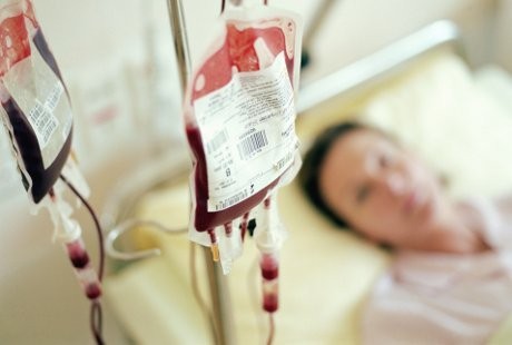 97 Persen Penyandang Lupus di Indonesia adalah Wanita