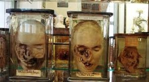 Ribuan Koleksi Menyeramkan di Museum Kedokteran Paris