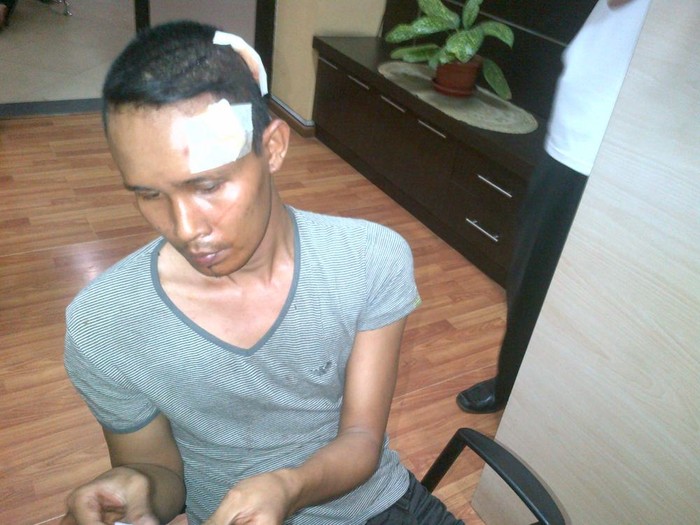 Mengaku Dipukuli Satpol PP, Pedagang Kaki Lima Lapor Polisi