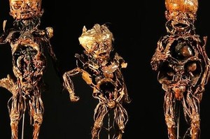 6 Museum Kedokteran Paling Aneh Sedunia