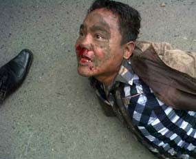 Dua Jambret Nasabah Bank Nyaris Tewas Dimassa, 1 Orang Ditembak