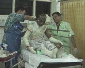 Kios Bensin Meledak, Lima Orang Sekeluarga Alami Luka Bakar