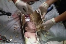 Bayi Baru Lahir di China Berhasil Diselamatkan dari Pipa Toilet