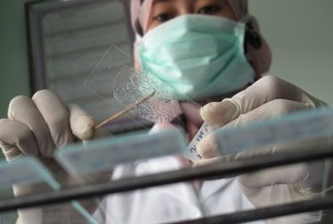 Wujudkan Indonesia Bebas TB, Forum Stop TB Partnership Diluncurkan