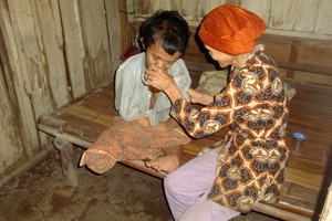 Tolong! Nenek di Banyumas Ini Amat Sangat Butuh Bantuan