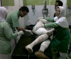 Seorang Mahasiswa Nekat Bakar Diri Gara-gara Putus Cinta