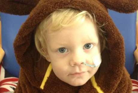 Kisah Bocah 18 Bulan yang Melepuh dan Hampir Meninggal Akibat Bakteri