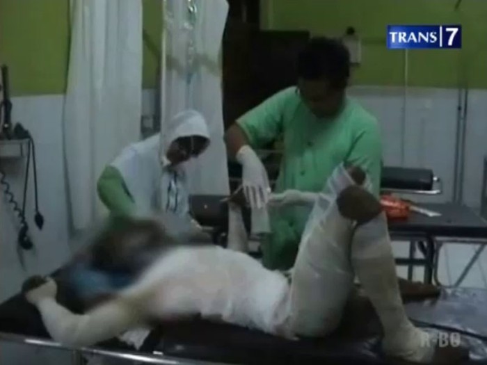 Putus Cinta, Mahasiswa Bakar Diri