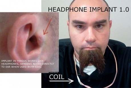 Rich Lee, Manusia Pertama yang Cangkok Headphone di Telinganya