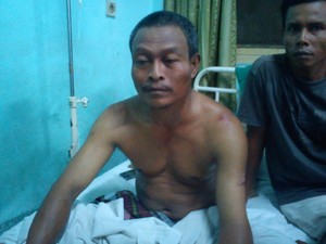 Tertimpa Rumah Ambrol di Tambora, 2 Pekerja Dirawat di RS Sumber Waras