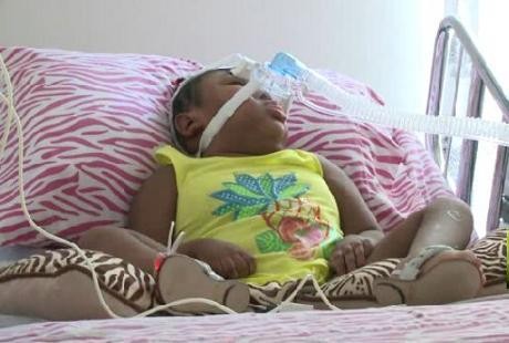 Kaliysha, Bocah 6 Tahun yang Terlahir Tanpa Otak