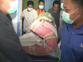 Seorang Perempuan Ditemukan Tewas Terbakar