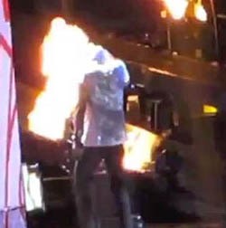 Duh, Rambut Harry Styles Terbakar di Atas Panggung