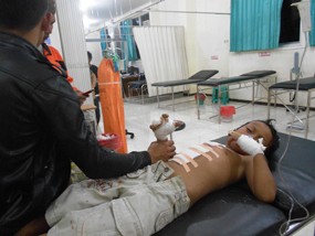 Main Korek Api, Jari Bocah 9 Tahun Putus