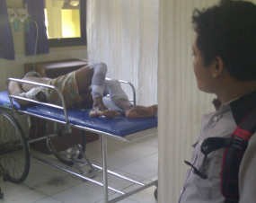 Tabung Las Meledak di PT Semen Indonesia, 7 Orang Luka Bakar