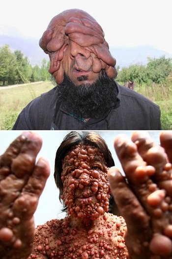 Orang-orang Bermuka Seram, Wajah Meleleh Hingga Manusia Gelembung