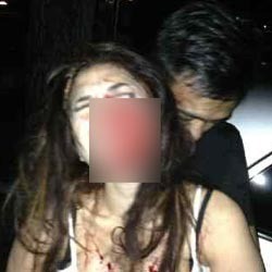 Ini Foto Lain Nikita Mirzani Babak Belur Berlumuran Darah