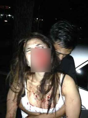 Ini Foto Lain Nikita Mirzani Babak Belur Berlumuran Darah