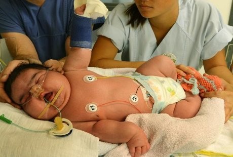 Bayi Perempuan 6,11 Kg Ini Lahir Normal di Jerman