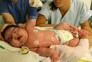 Bayi Perempuan 6,11 Kg Ini Lahir Normal di Jerman