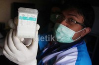 Tes yang dilakukan berupa pemeriksaan fisik seperti pupil mata dan garis lengan, dan tes urin