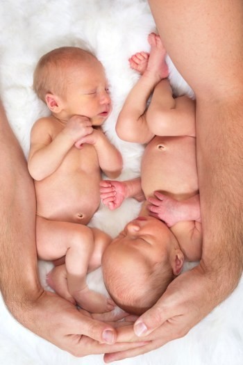 Pasangan Kembar Tak Biasa, Beda Golongan Darah Hingga Warna Kulit