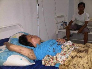 Dianiaya di Malaysia, TKW Asal Kalbar Pulang Dalam Kondisi Luka