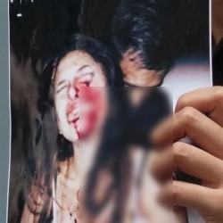 Nikita: Fia Ujuk-ujuk Datang Mukul, Dia Pikir Muka Aku Samsak Tinju Kali