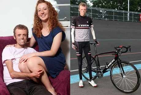 Kisah Asmara Pria dengan Kondisi Langka Tak Berlemak dan Kekasih Setianya