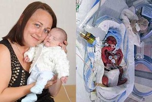 Meski Bobot Lahir Tak Sampai 1 kg, Bayi Prematur Ini Mampu Bertahan Hidup