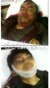 2 Polisi di Pondok Aren Ditembak di Bagian Kepala & Punggung 