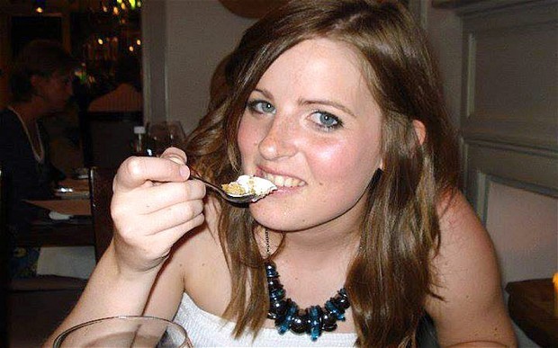 Mulut Menganga Terlalu Lebar Saat Makan Burger, Rahang Wanita Ini Geser