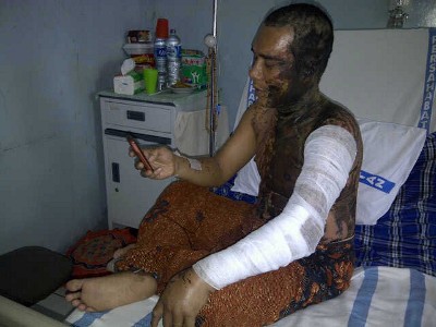 Tak Terima Suara Bising Adang Siram Tetangga Dengan Air Keras