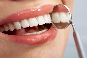 Ingin Periksa Gigi Gratis? Bulan Kesehatan Gigi Nasional Siap Dimulai