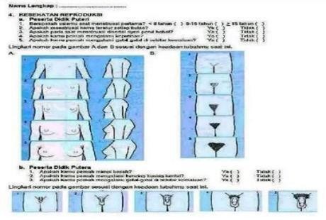 Tanya Ukuran Kelamin Anak SMP Via Kuesioner, Apa Alasan Dinkes Sleman?