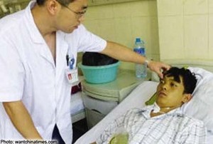 Seperti Hulk, Tubuh Pria Ini Jadi Hijau Setelah Makan Siput Sungai