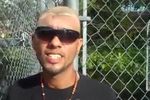 Carlos Halfy Rodriguez, Pria Alien yang Kepalanya Tinggal Separuh