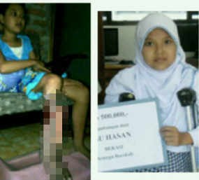 Orangtua Tak Ada Biaya, Ira Hanya Dibawa ke Sangkal Putung