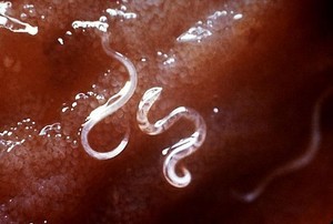 Waspada! Kondisi Ini yang Bikin Cacing Mudah Masuk ke Tubuh Manusia