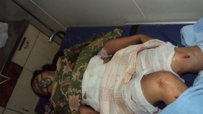 Seorang Suami Tega Bakar Istri