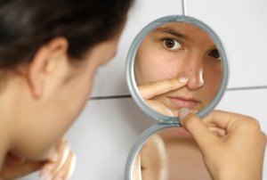 Daftar Pengobatan Rumahan yang Bisa Usir Jerawat di Hidung