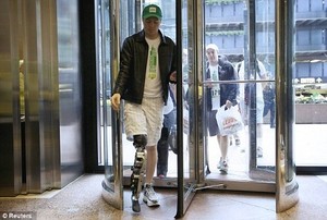 Bukan Telepati, Kini Kaki Buatan Bisa Dikendalikan Lewat Pikiran