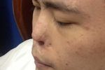 Inilah Xiaolian, Pria yang Punya Hidung di Dahinya