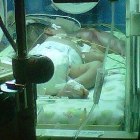 Kondisi Bayi Ginan Semakin Membaik